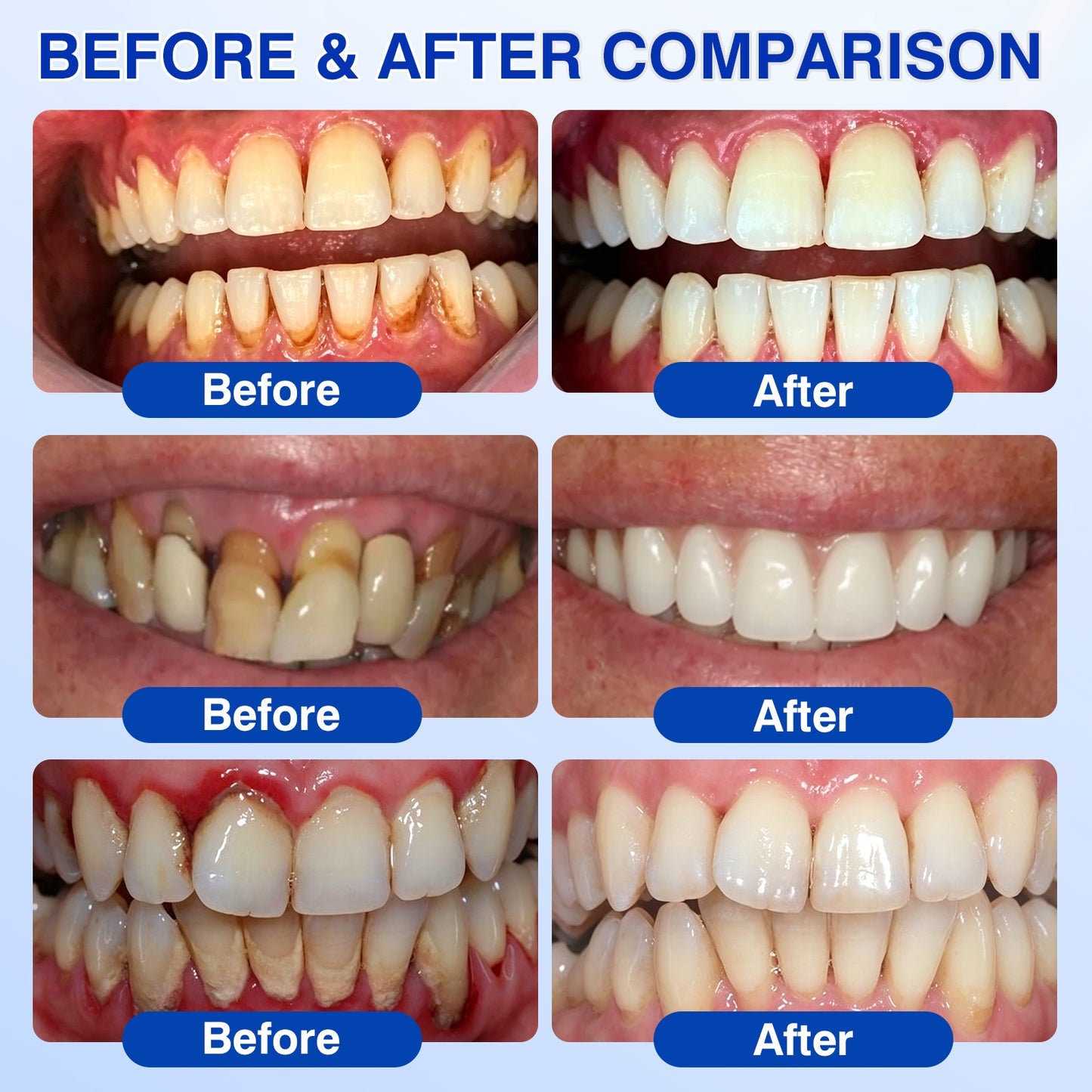 🇮🇪🏅🦷🛡️𝐍𝐚𝐭𝐫𝐚𝐯𝐨𝐫® GumRevive Gum & Periodontal Care Gel