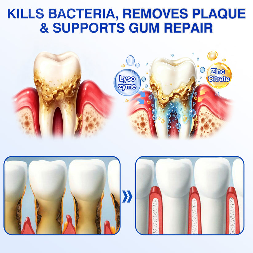 🇮🇪🏅𝐍𝐚𝐭𝐫𝐚𝐯𝐨𝐫® GumRevive Gum & Periodontal Care Gel