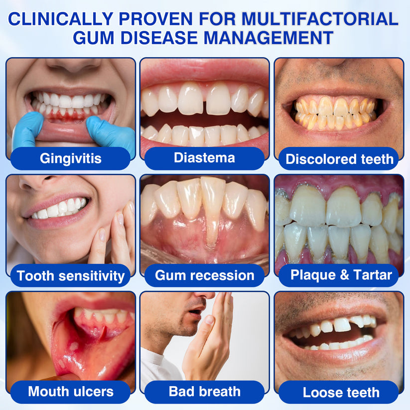 🦷𝐍𝐚𝐭𝐫𝐚𝐯𝐨𝐫® GumRevive Gum & Periodontal Care Gel