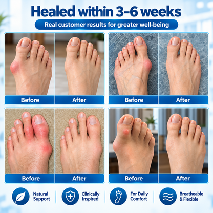 🏅Natravor® Relief Botanical Bunion Comfort Patcht👠💃（Physical Stretch Support + Botanical Comfort Formula)a