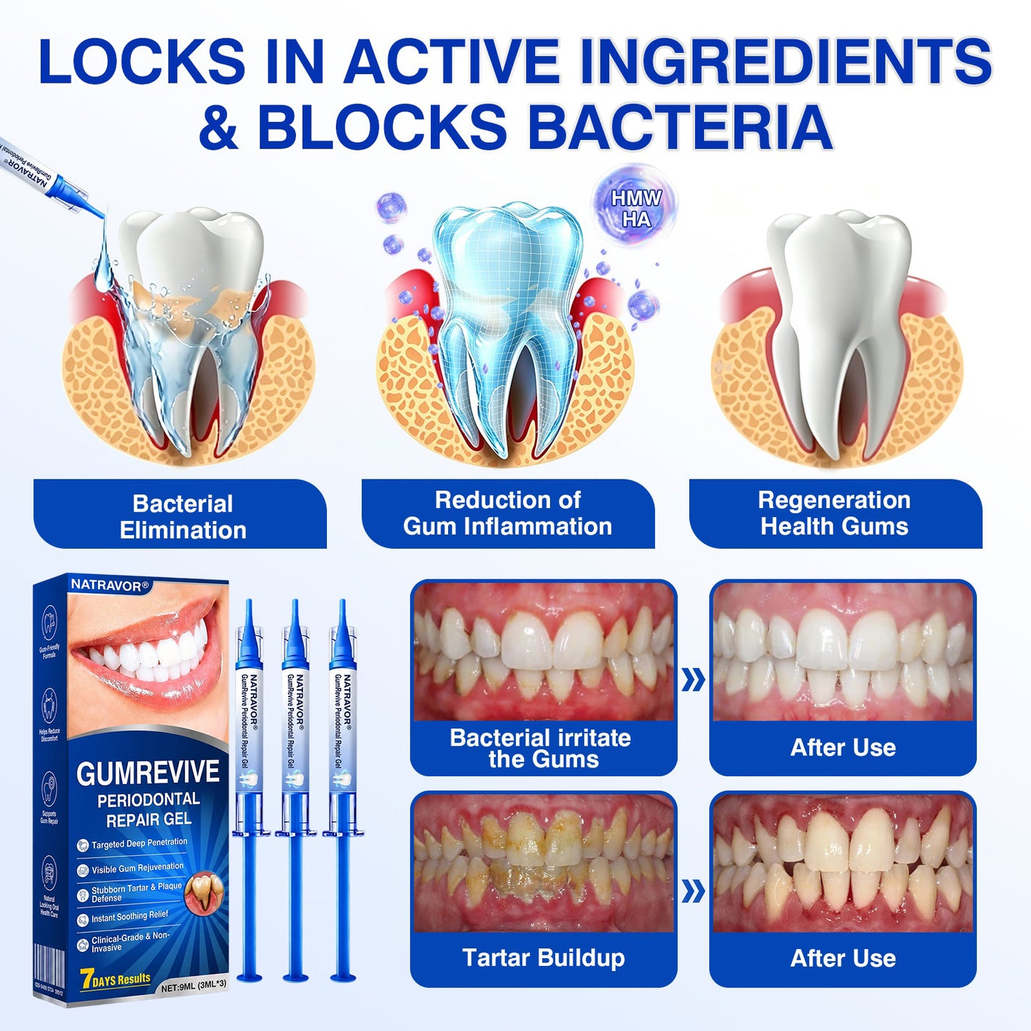 🦷𝐍𝐚𝐭𝐫𝐚𝐯𝐨𝐫® GumRevive Gum & Periodontal Care Gel